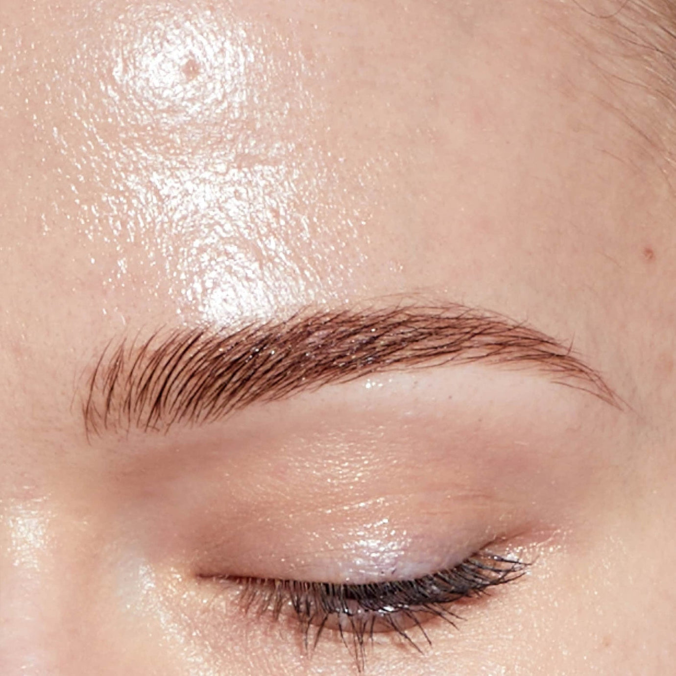 Enlarged Pores