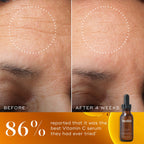 A before and after comparison highlights reduced wrinkles and boosted radiance from Medik8's C-Tetra® Luxe (Travel Size) Vitamin C serum, paired with an image of the bottle boasting an 86% approval rating. This potent formula brightens while smoothing imperfections.