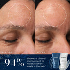 A "Before" and "After" comparison of a forehead shows visible lines smoothing with 94% improved moisturization after using Medik8's H.E.O.® Mask, highlighting its effectiveness in enhancing skin hydration overnight.