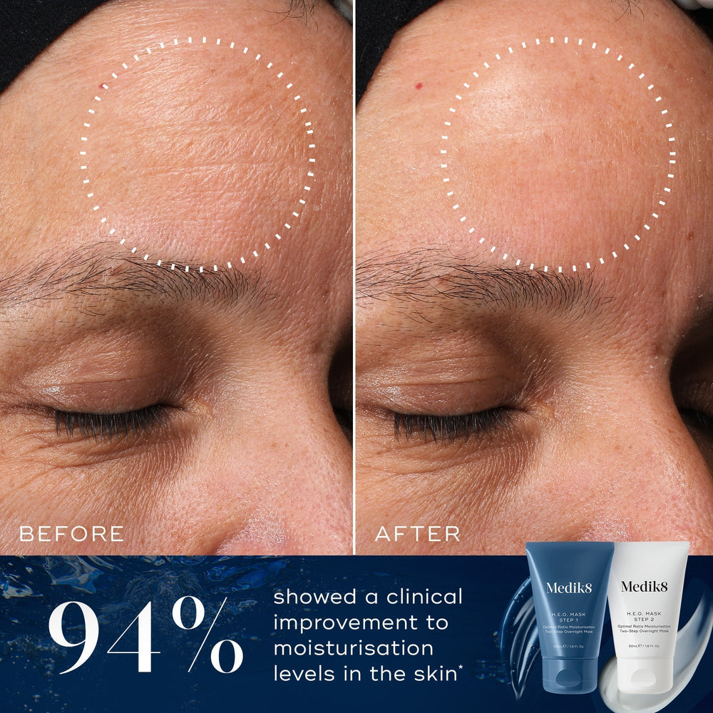 A "Before" and "After" comparison of a forehead shows visible lines smoothing with 94% improved moisturization after using Medik8's H.E.O.® Mask, highlighting its effectiveness in enhancing skin hydration overnight.