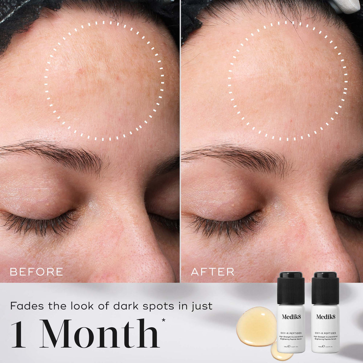 Side-by-side comparison of a forehead with fewer dark spots after using Medik8's Oxy-R Peptides™ for a month. Two small bottles in the bottom right corner emphasize this brightening serum's effectiveness.