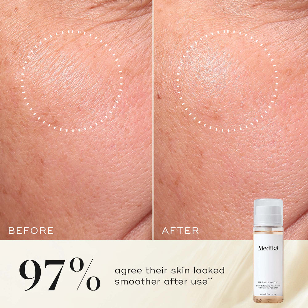 Close-up of skin before and after using Medik8's Press & Glow™ (Travel Size), showcasing smoother skin. Text: "97% agree their skin looked smoother after use, even on sensitive skin." Image of the Press & Glow™ bottle with exfoliating poly hydroxy acids.