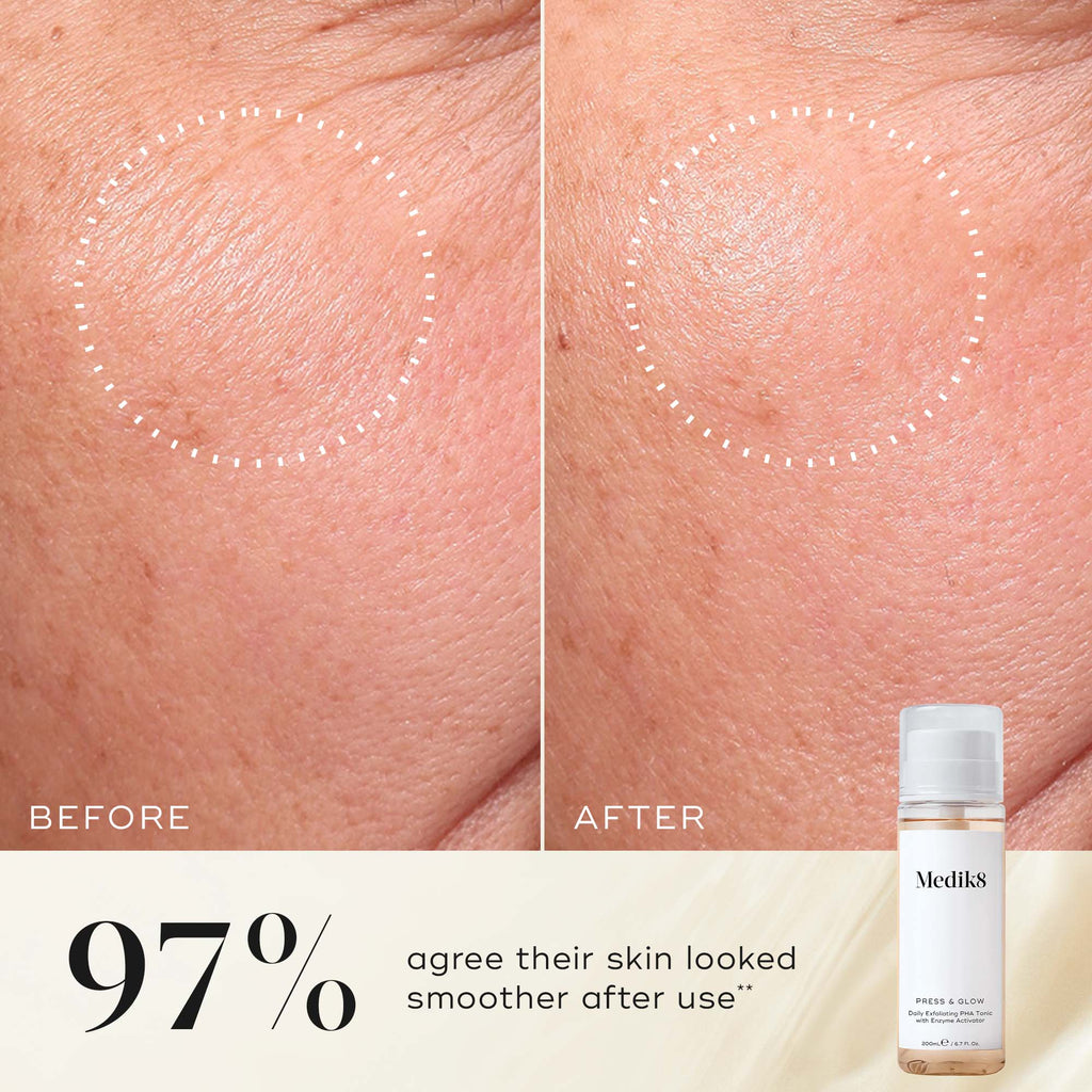 Close-up of skin before and after using Medik8's Press & Glow™ (Travel Size), showcasing smoother skin. Text: "97% agree their skin looked smoother after use, even on sensitive skin." Image of the Press & Glow™ bottle with exfoliating poly hydroxy acids.