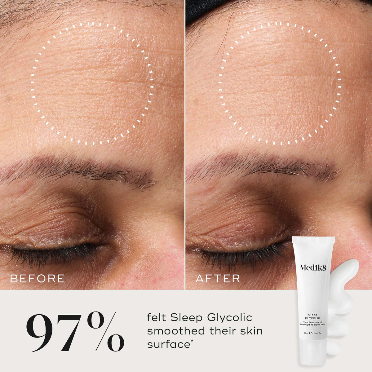The comparison image shows a forehead before and after using Medik8's Sleep Glycolic™. The "before" image has more visible lines, while the "after" reveals smoother skin, demonstrating the revitalizing power of glycolic acid in this product.
