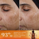 Close-up of a face illustrating skin-brightening improvement with Medik8's Super C Ferulic™. Left: before treatment. Right: after 28 days. 93% of users prefer it for sun aging over other products. Product bottle displayed.
