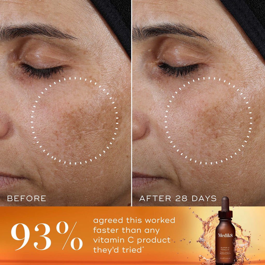 Close-up of a face illustrating skin-brightening improvement with Medik8's Super C Ferulic™. Left: before treatment. Right: after 28 days. 93% of users prefer it for sun aging over other products. Product bottle displayed.