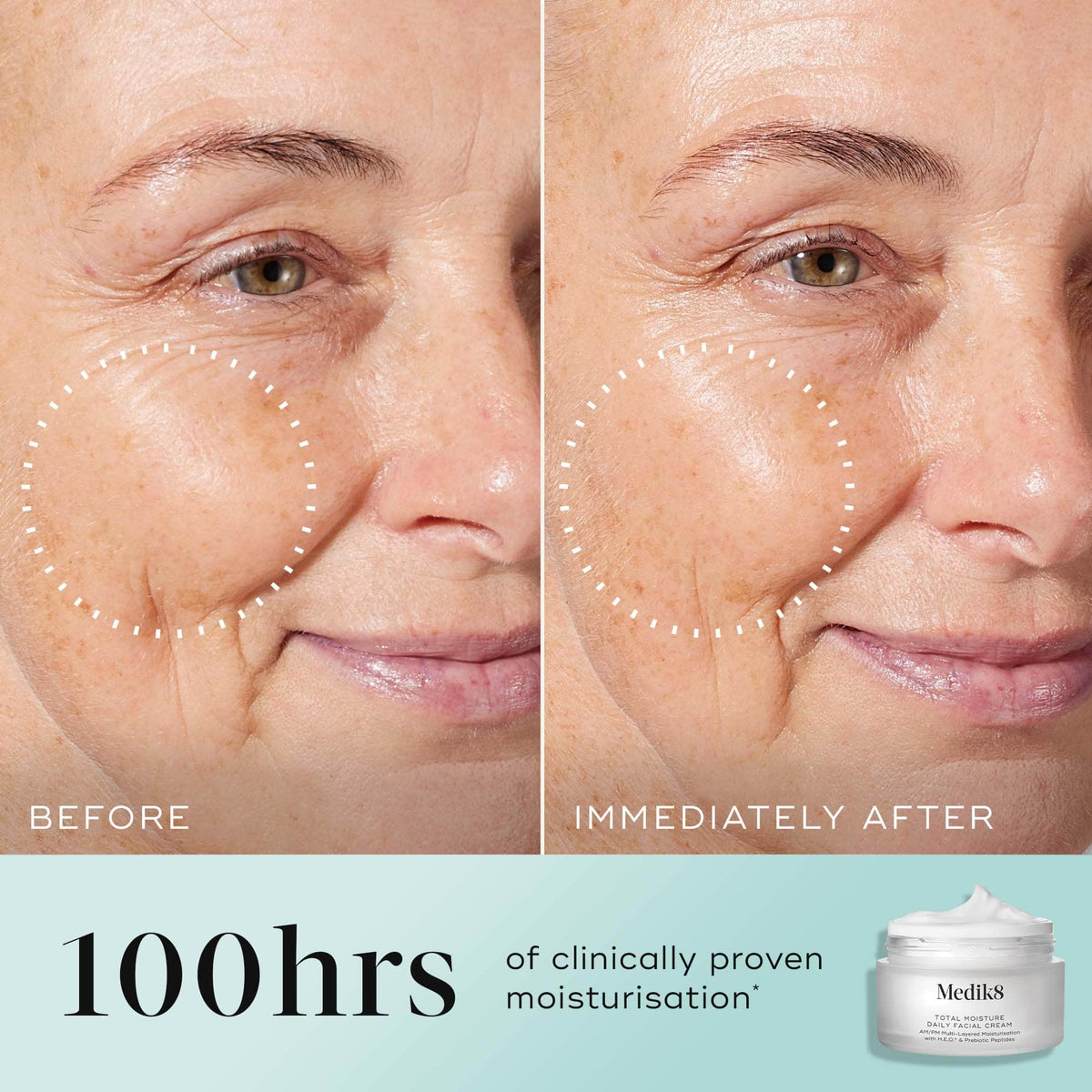 Side-by-side comparison shows a woman's cheek before and after applying Medik8's Total Moisture Daily Facial Cream™, revealing deeply moisturized skin and reduced wrinkles. Image text: "100hrs of clinically proven moisturization" and "formulated with prebiotic peptide to enhance microbiome support.