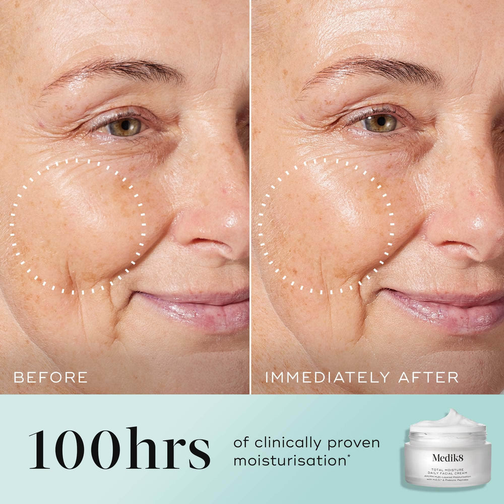 Side-by-side comparison shows a woman's cheek before and after applying Medik8's Total Moisture Daily Facial Cream™, revealing deeply moisturized skin and reduced wrinkles. Image text: "100hrs of clinically proven moisturization" and "formulated with prebiotic peptide to enhance microbiome support.