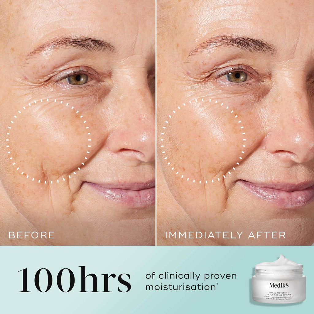 Side-by-side comparison shows a woman's cheek before and after applying Medik8's Total Moisture Daily Facial Cream™, revealing deeply moisturized skin and reduced wrinkles. Image text: "100hrs of clinically proven moisturization" and "formulated with prebiotic peptide to enhance microbiome support.