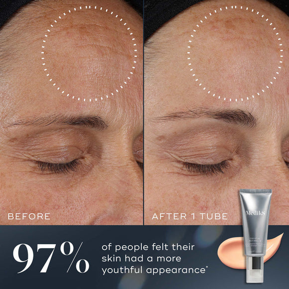 Before and after comparison of a woman's forehead using Medik8's Crystal Retinal® shows reduced aging signs, with a tube in the corner. Text indicates 97% reported more youthful skin.-hover-
