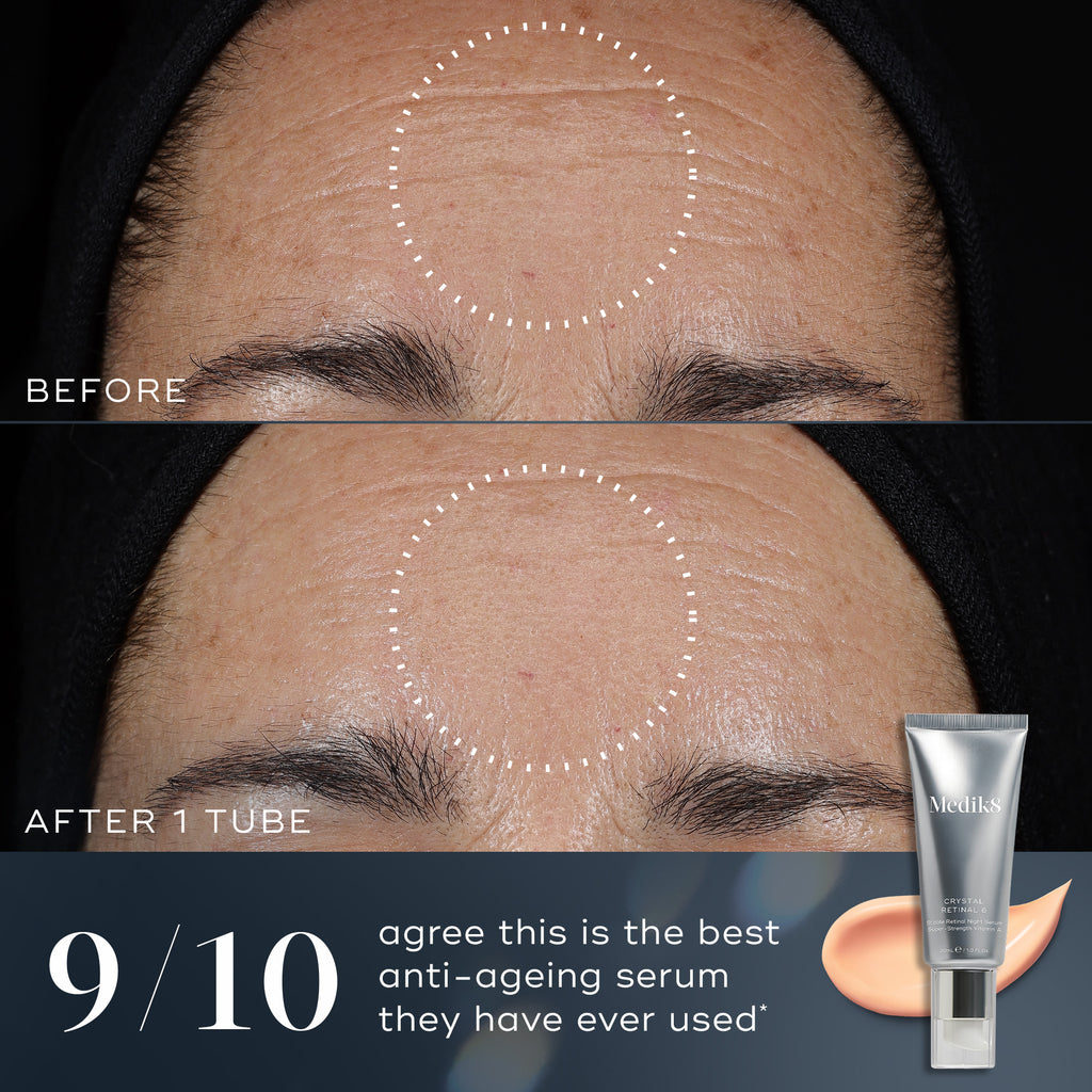 A close-up shows a forehead with reduced wrinkles before and after using Medik8's Crystal Retinal®. A tube of the vitamin A serum is displayed, with text claiming 9 out of 10 users prefer this transformative anti-aging solution.