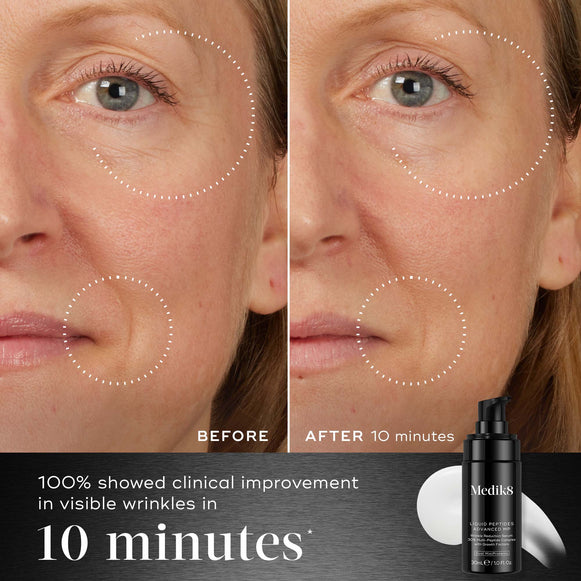 Comparing side-by-side, Medik8 Cyprus's Liquid Peptides Advanced MP serum delivers transformative effects, significantly reducing wrinkles. Text states 100% improvement in visible wrinkles within just 10 minutes.