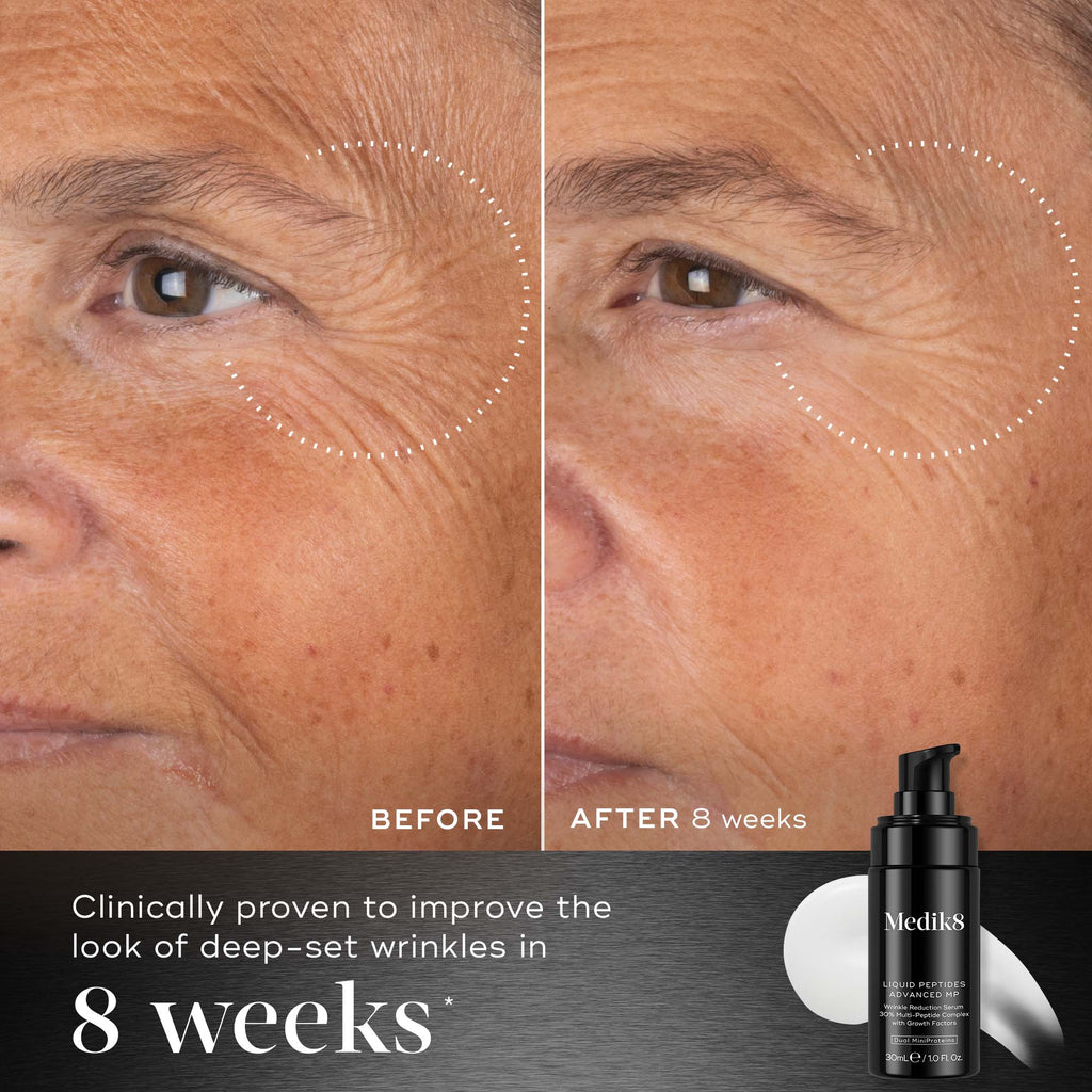 Split image shows skin transformation after 8 weeks with significant wrinkle reduction due to Medik8 Cyprus Liquid Peptides Advanced MP. The sleek black bottle with a pump, in the bottom right, contains these powerful MiniProteins.