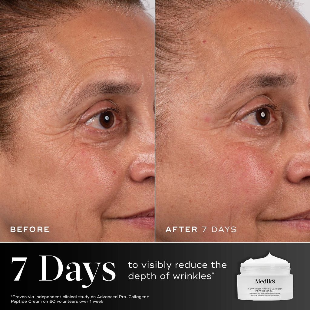 Side-by-side close-up of a woman's face shows fewer wrinkles and firmer skin after 7 days using Medik8 Cyprus Advanced Pro-Collagen+ Peptide Cream (Travel Size), with product image and descriptive text below.