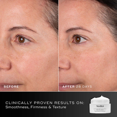 Side-by-side close-up of a woman's face reveals fewer fine lines and firmer skin after 28 days using Medik8 Cyprus Advanced Pro-Collagen+ Peptide Cream (Travel Size); text emphasizes clinically proven results.