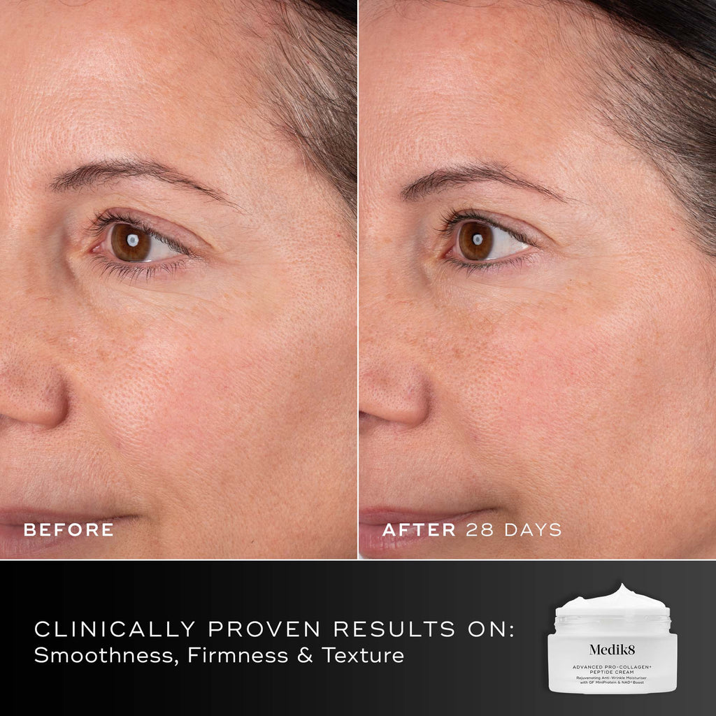 Side-by-side close-up of a woman's face reveals fewer fine lines and firmer skin after 28 days using Medik8 Cyprus Advanced Pro-Collagen+ Peptide Cream (Travel Size); text emphasizes clinically proven results.