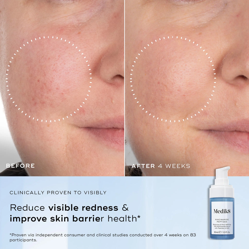 Side-by-side close-up of a cheek shows reduced redness and glass-skin smoothness after 4 weeks using Medik8 Cyprus Niacinamide Peptides; product bottle and serum visible at bottom right.
