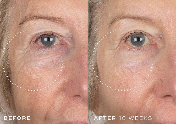 Crystal Retinal — before and after results