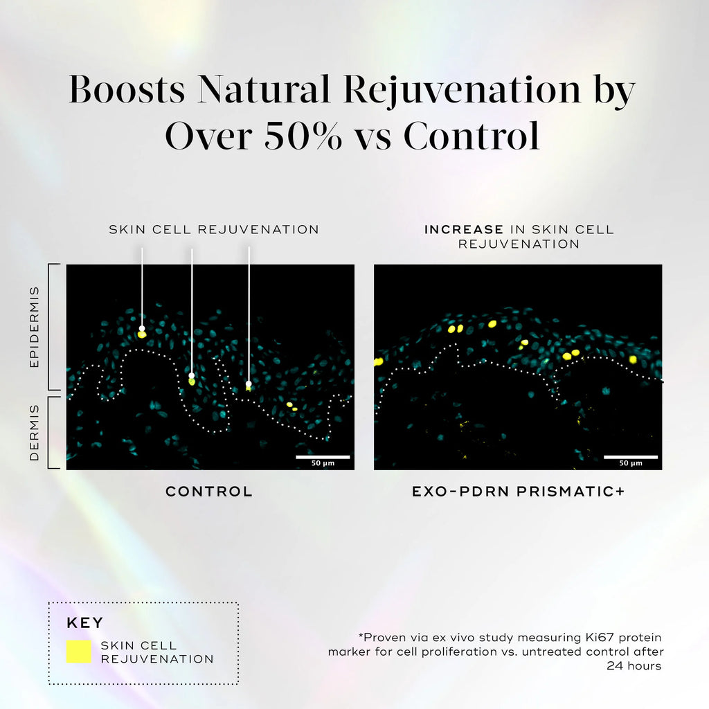 Side-by-side graphs show increased skin cell rejuvenation in the epidermis and dermis with Exo-PDRN Prismatic+ by Medik8 Cyprus compared to control, using yellow dots to represent rejuvenation.