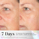 Side-by-side comparison of a woman's face before and after 7 days using Exo-PDRN Prismatic+ by Medik8 Cyprus, revealing reduced wrinkles and smoother skin texture in the "after" photo.