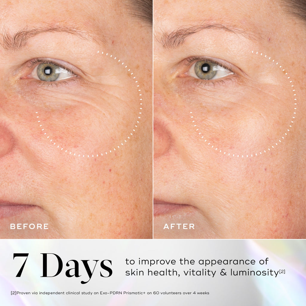 Side-by-side comparison of a woman's face before and after 7 days using Exo-PDRN Prismatic+ by Medik8 Cyprus, revealing reduced wrinkles and smoother skin texture in the "after" photo.