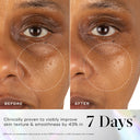Close-up of a person's cheek and under-eye area before and after 7 days using Medik8 Cyprus Exo-PDRN Prismatic+, highlighting visibly smoother skin texture and reduced roughness.