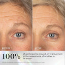 Close-up comparison of a woman's forehead and eye area before and after 14 days using Exo-PDRN Prismatic+ by Medik8 Cyprus, showing reduced wrinkles. Text states 100% of participants saw improvement in wrinkle appearance.