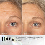 Close-up comparison of a woman's forehead and eye area before and after 14 days using Exo-PDRN Prismatic+ by Medik8 Cyprus, showing reduced wrinkles. Text states 100% of participants saw improvement in wrinkle appearance.