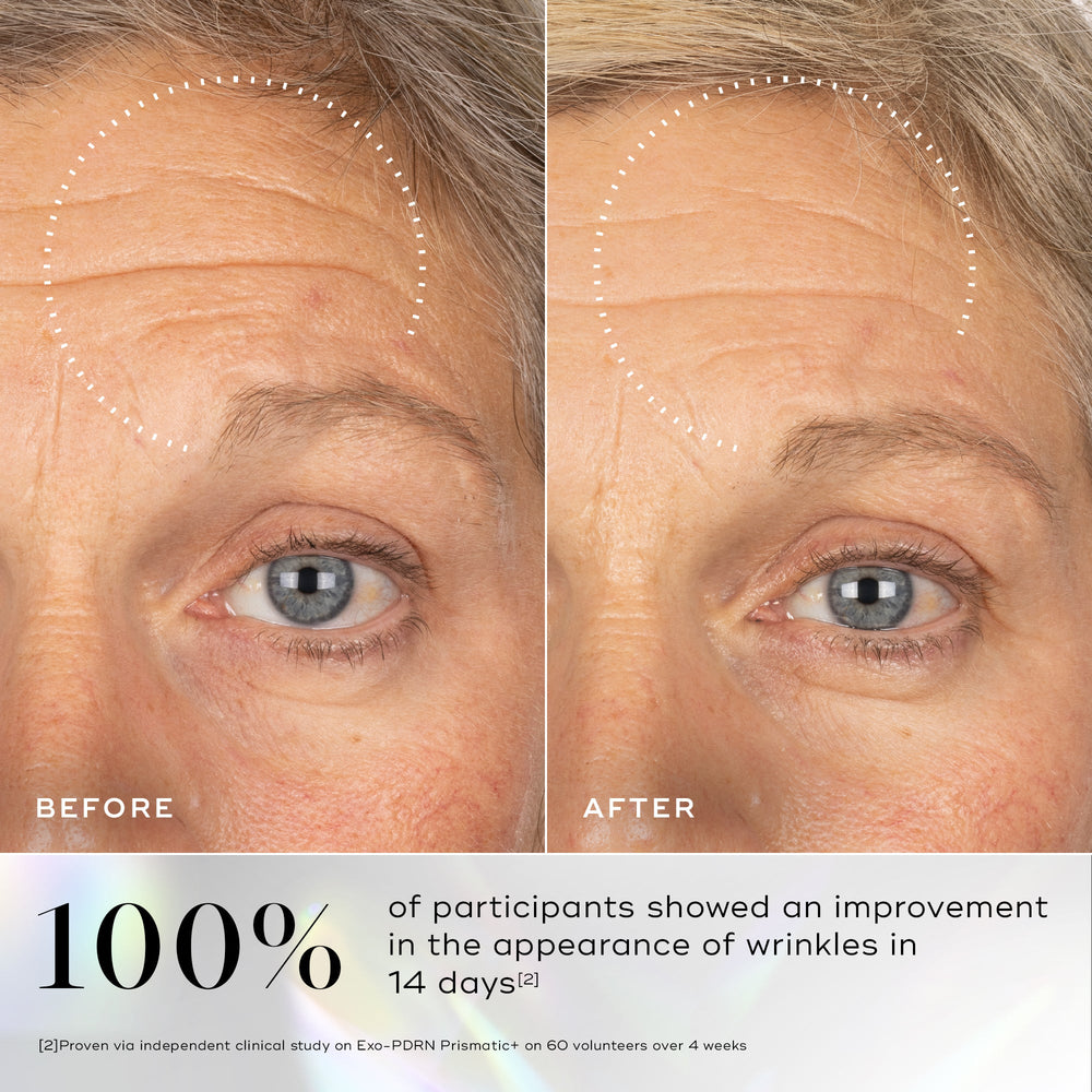 Close-up comparison of a woman's forehead and eye area before and after 14 days using Exo-PDRN Prismatic+ by Medik8 Cyprus, showing reduced wrinkles. Text states 100% of participants saw improvement in wrinkle appearance.
