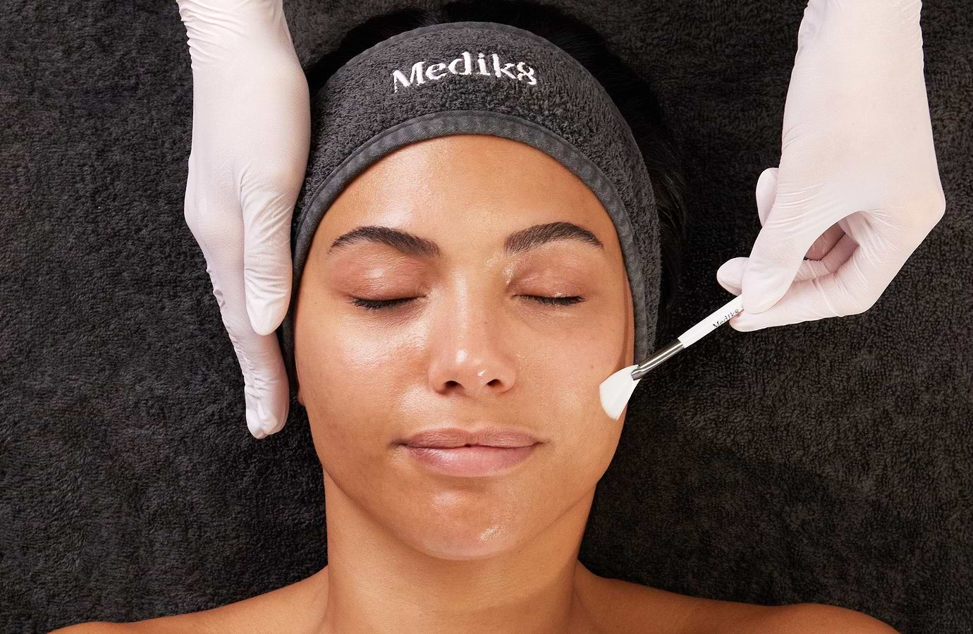 After Chemical Peels
