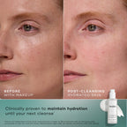 Side-by-side close-up of a woman's cheek before with makeup and after cleansing with hydrated skin using Medik8 Cyprus Total Moisture Daily Cleansing Gel, shown next to the product bottle and clinical claim text.