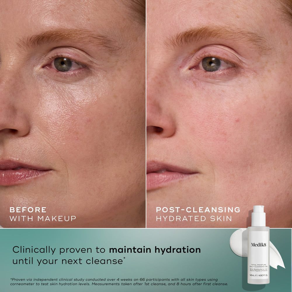 Side-by-side close-up of a woman's cheek before with makeup and after cleansing with hydrated skin using Medik8 Cyprus Total Moisture Daily Cleansing Gel, shown next to the product bottle and clinical claim text.