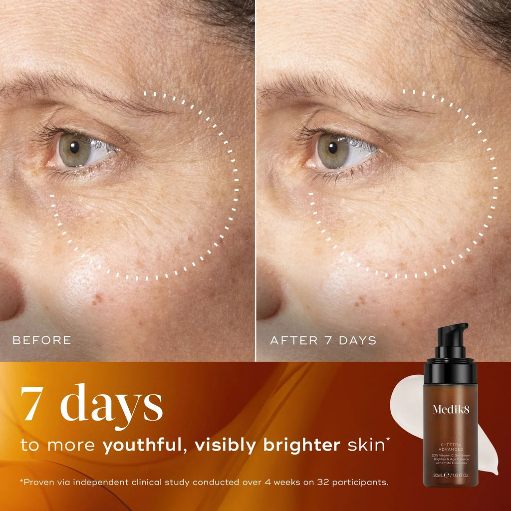 Side-by-side close-up of a person's eye area shows skin before and after 7 days of using Medik8 Cyprus C-Tetra® Advanced, with text highlighting accelerated skin brightening and visibly more youthful, radiant skin in just one week.